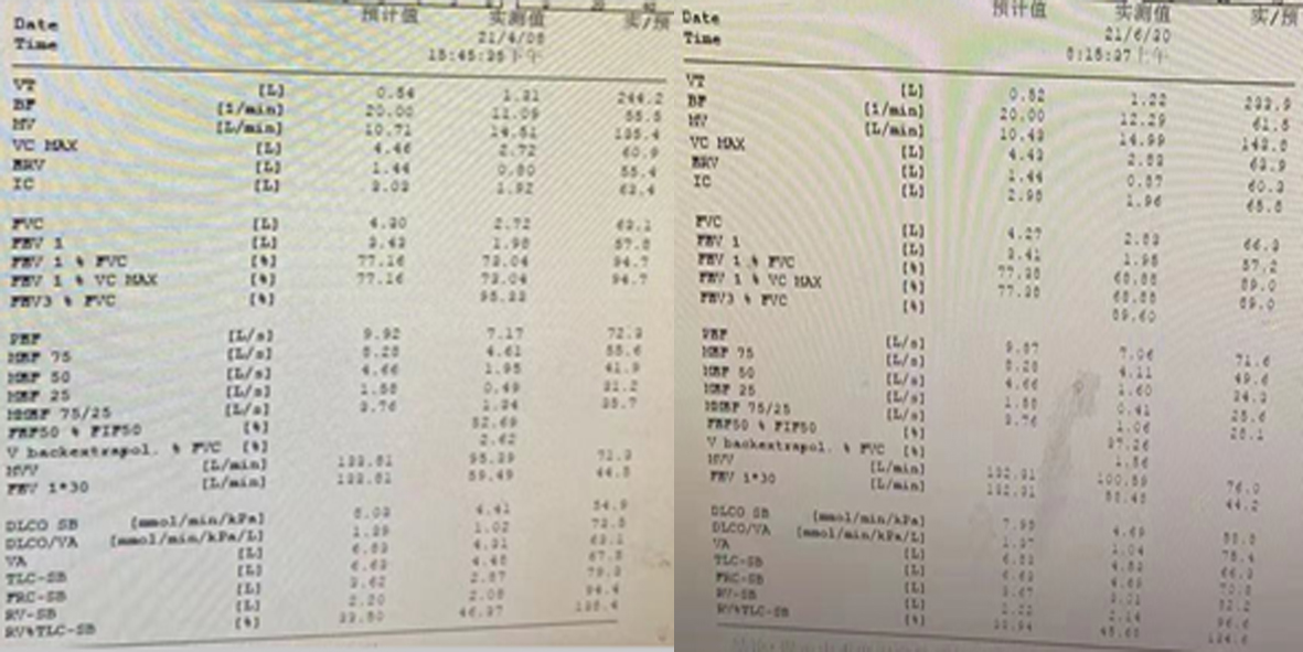 D先生基线期与4周后的肺功能检查.jpg