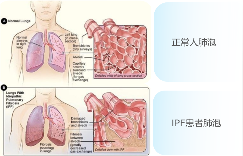 临床介绍11.png